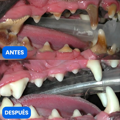 Denvora™ - Abreboca Dental 2 en 1